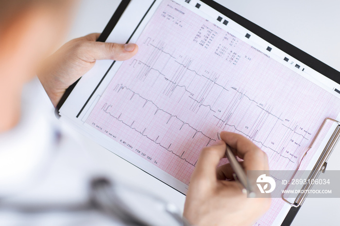 male doctor hands with cardiogram