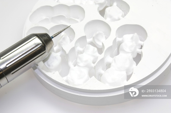 Vollkeramik Zirkonoxid CAD CAM牙科
