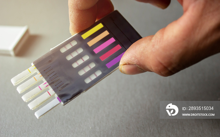 A man holds a test strips to determine the prohibited substances in the body