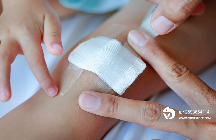 Close up wound on child knee. Mother dressing childs knee.