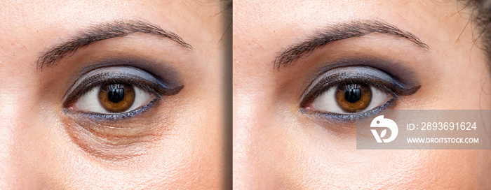 Before and after makeup looks concealing the dark circles