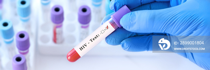 Doctor’s hand holds test tube in blood on the background of test tubes with analyzes.Blood sample positive with HIV testing. Banner.