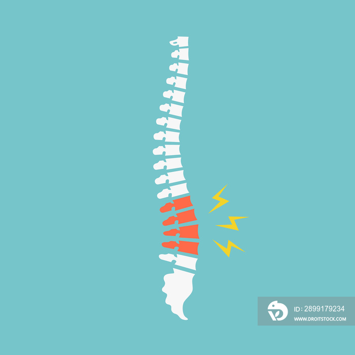 背痛。蓝色背景上隔离的背痛矢量图标。背部椎间盘受损