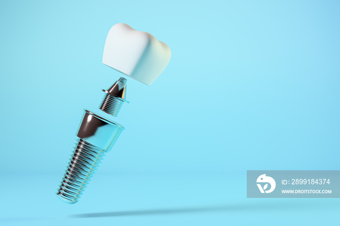 Dental implant, dental prosthesis. 3d rendering