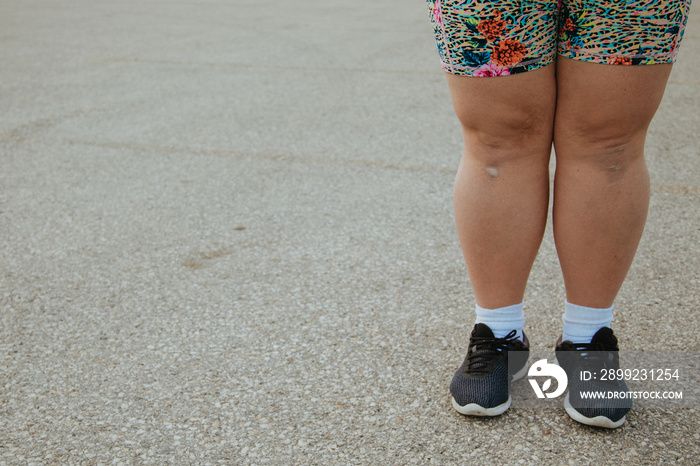 closeup of plus size woman’s legs standing on concrete