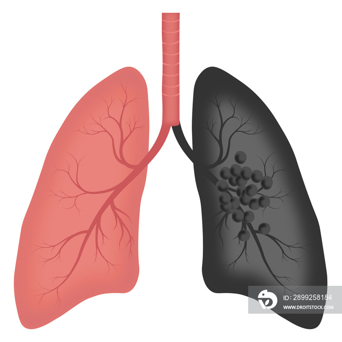 healthy lung and black lungs toxic from toxic smoke effect to human lungs 02