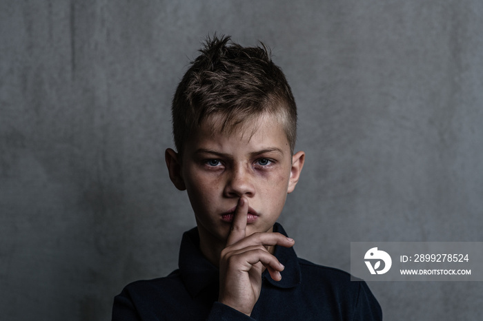 Young beaten up boy looking at camera and holding finger on mouth. Empty space for text