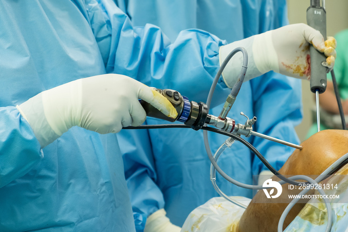 arthroscope surgery