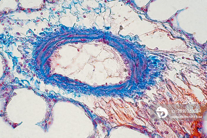 Human lung tissue under microscope view.