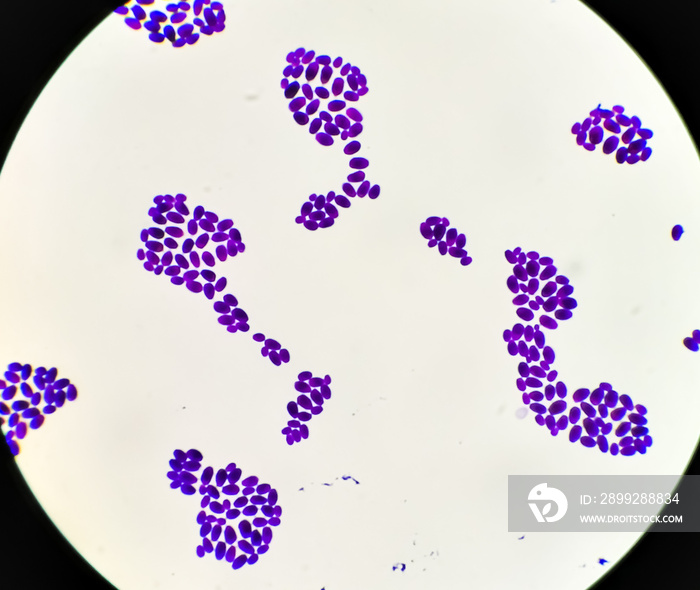 Culture colonies gram stained Microscopic 100x show Candida spp, fungi, emerging multidrug fungus. Candida albicans, C. auris and other yeast fungi. Close up micrograph. laboratory analysis