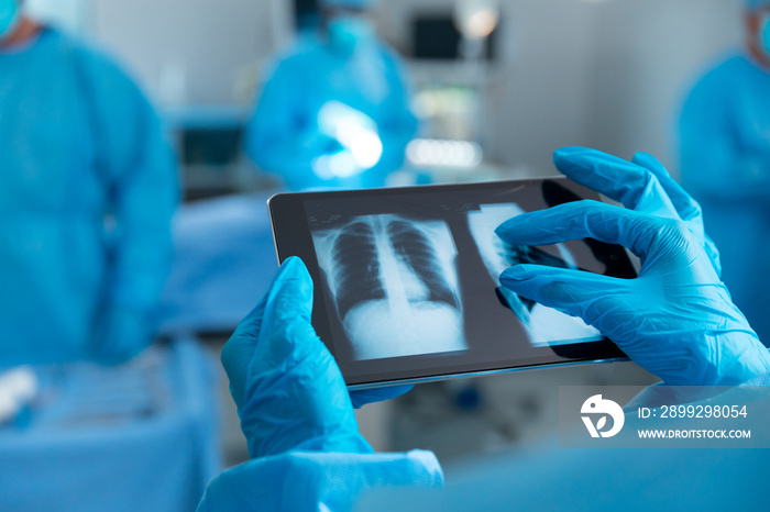 Doctor wearing surgical gloves looking at lung x-ray on tablet