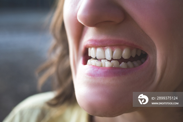 Photo of crooked woman teeth