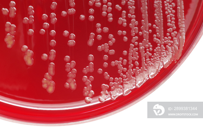 Staphylococcus aureus bacterial colonies on blood agar plate