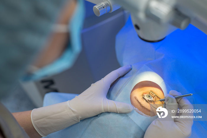 A close-up of the hands of an ophthalmologist surgeon looking through a microscope using microsurgical instruments for eye surgery in a patient.