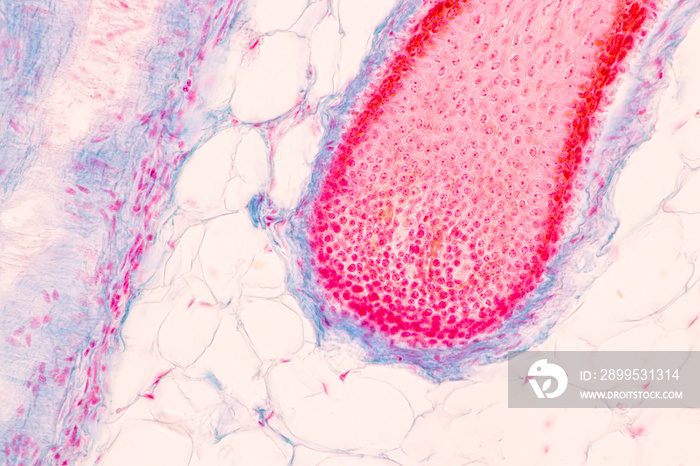 Scalp and hair follicles of human under the microscope in Lab.