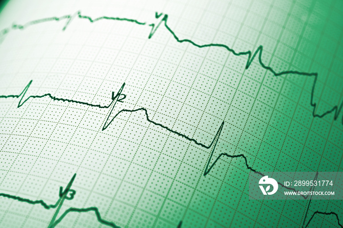 Electrocardiograph close up