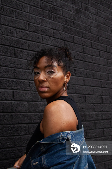 Mid-sized model with vitiligo posing in front of black wall and staring into the camera