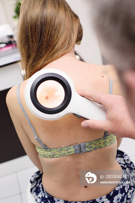 The dermatologist examines the patient’s moles with the help of a special electoral magnifying glass. Prevention of melanoma.