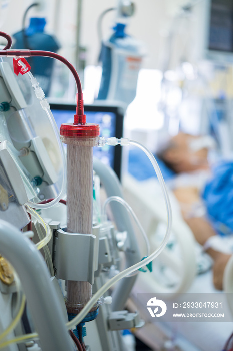 Experts are preparing a dialysis machine for use in critically ill patients in hospital intensive care units.