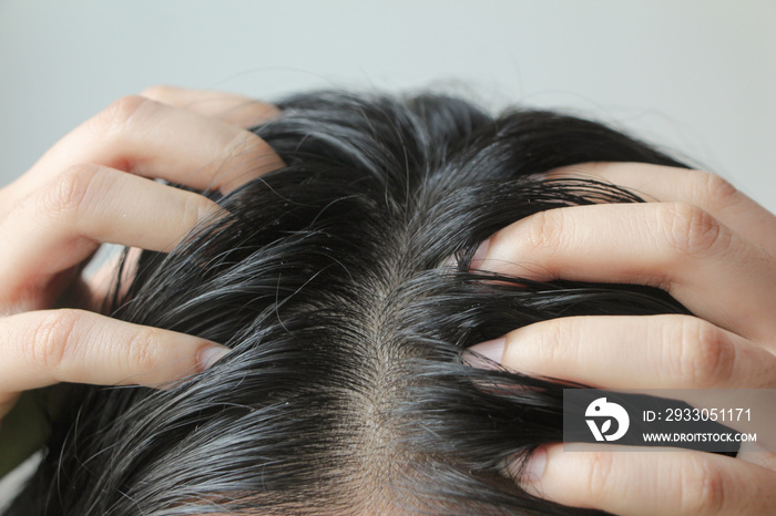 Close-up on head of Asian people have long black hair, having problems with greasy oily hair,  showing scalp, scratching herself, dandruff problem.