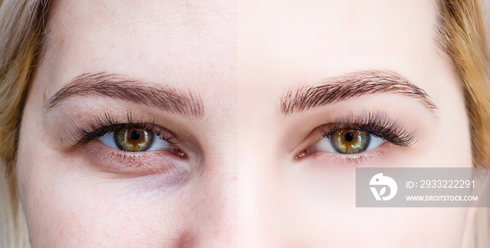 Beauty and fashion concept - Eyelash Extension Procedure. Before and after. Woman Eyes with Long fal