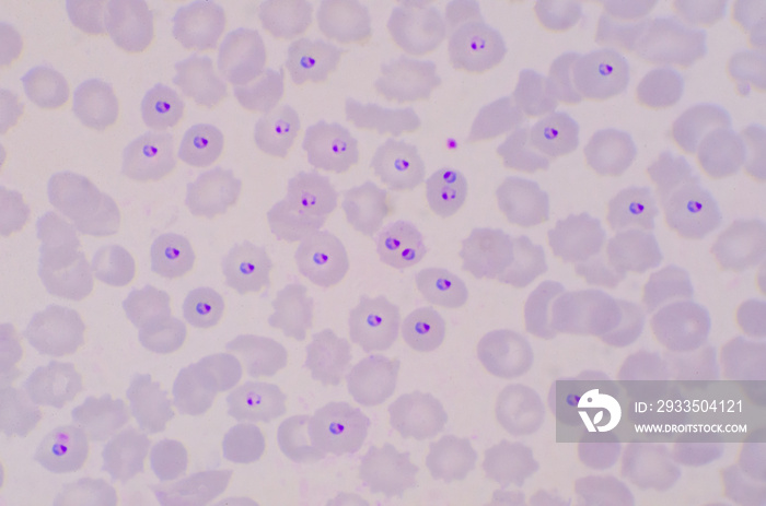 Plasmodium blood parasite ring form stage infected redblood cells