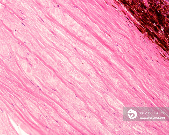 Dense connective tissue. Sclera