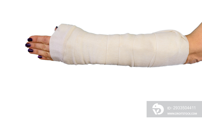 Woman broken arm bone in cast, plastered hand on white isolated background.