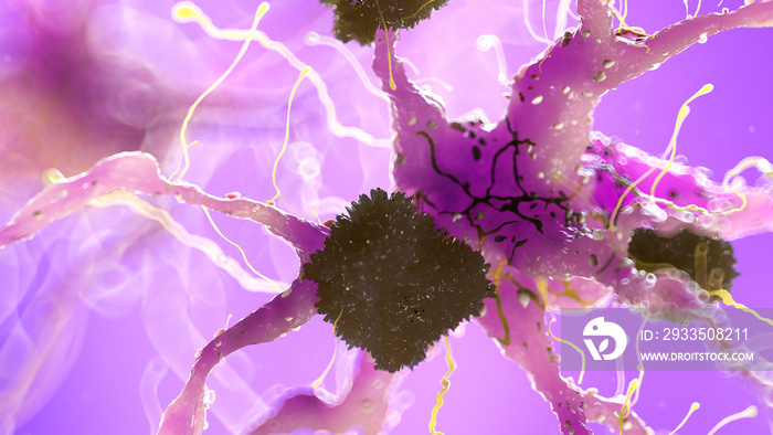 3d rendered medically accurate illustration of amyloid plaques on a nerve cell - alzheimer disease