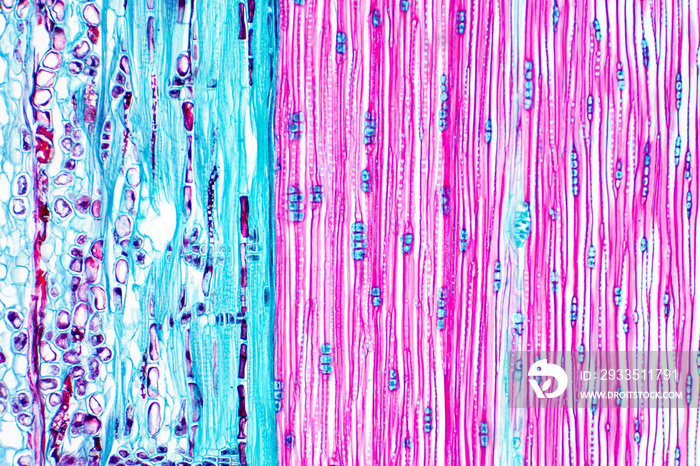 Histological structure of pine stem vascular bundle under microscope.