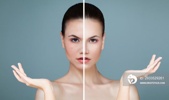 Portrait of Young Woman Showing Empty Copy Space on the Open Hand for Cream Tube. Facial Treatment, Medicine and Cosmetology Concept