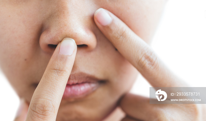 Pores in the nose of women.