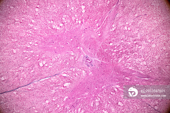 Cross section of the Cerebellum and Nerve human under the microscope for education in Lab.