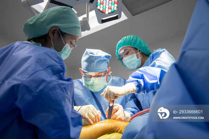 Team of doctor doing surgery inside modern operating room with orange effect. Asian orthopedic surgeon in blue surgical gown suit under surgical lamp.Fracture fixation was done in car accident patient