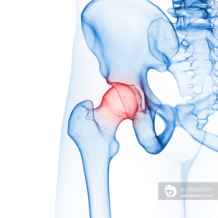 髋关节的三维医学精确图示