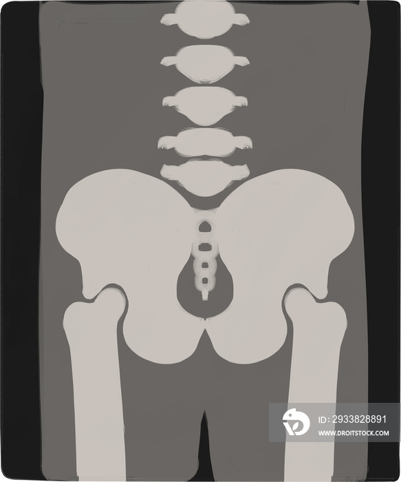 Diverse Xrays Pelvis