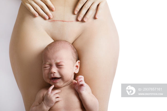 新生儿和母亲腹部剖腹产后有疤痕